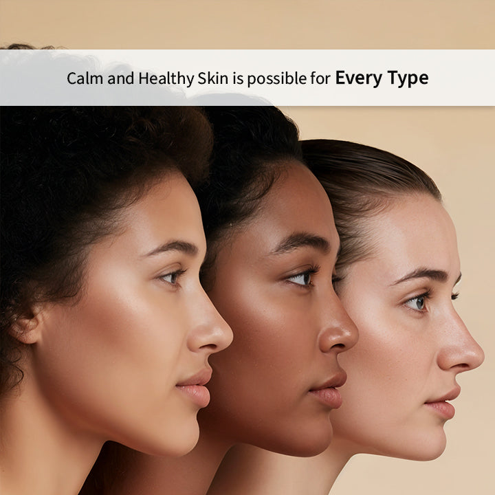How To Manage Sensitive Skin in Different Skin Types