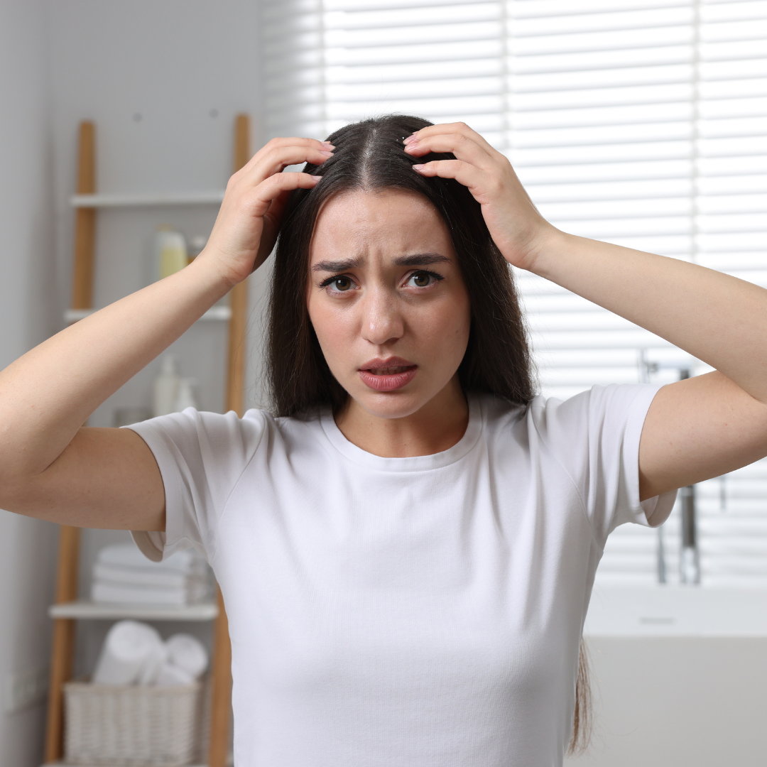 How Does Dry, Itchy, and Oily Scalp Lead to Dandruff